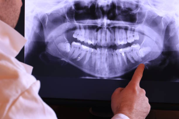 Best Urgent Care for Lost Fillings or Crowns in Morristown, TN