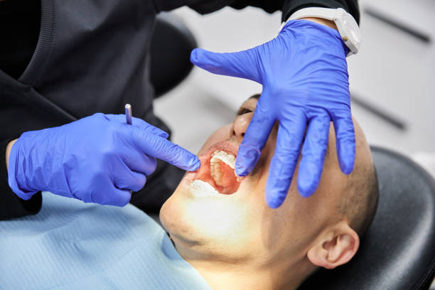 Best Emergency Gum Treatment in Morristown, TN