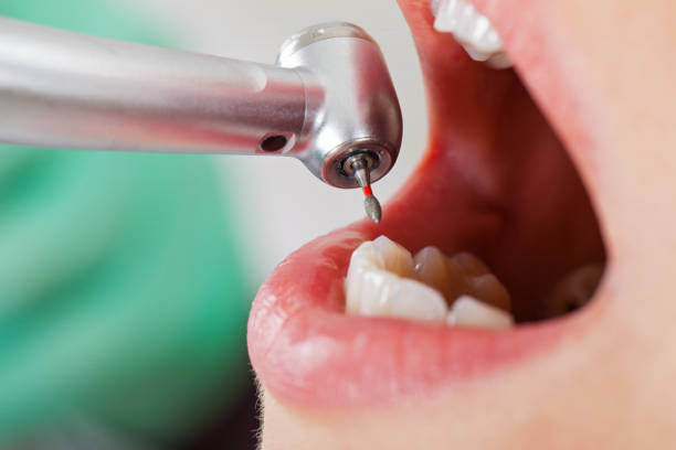 Best Pediatric Emergency Dentist in Morristown, TN